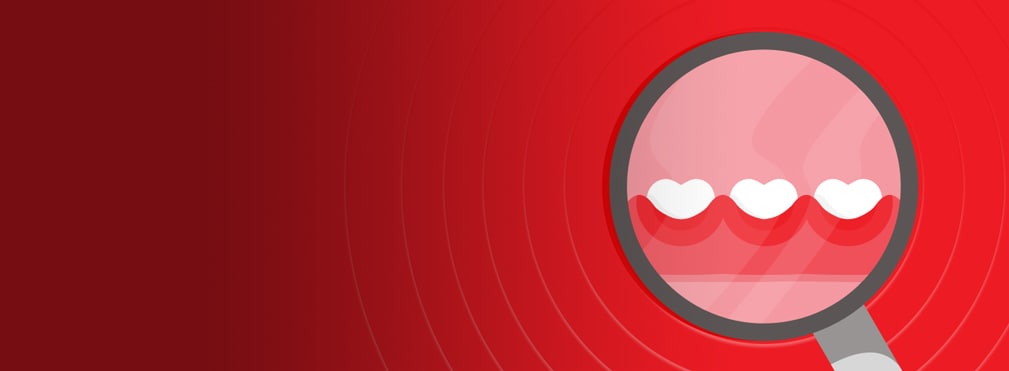 nướu bị viêm nướu bị viêm